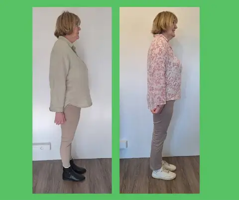 Cliché de profil d’une membre, avant puis après son passage au club