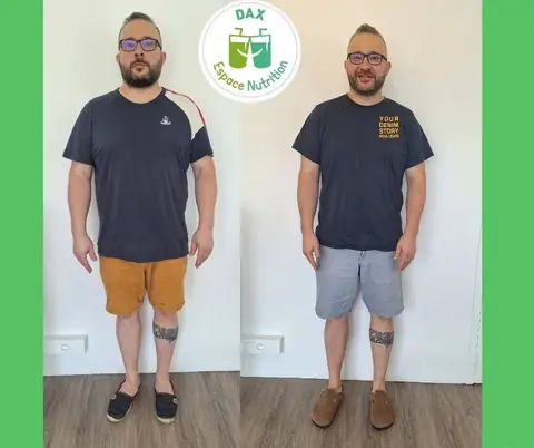 Une membre du club Dax Espace Nutrition de face, avant puis après